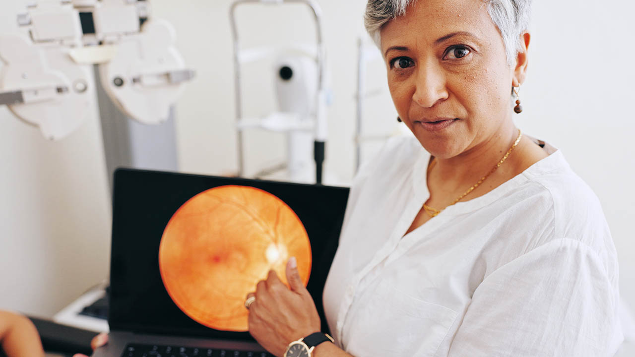 ניוון רשתית